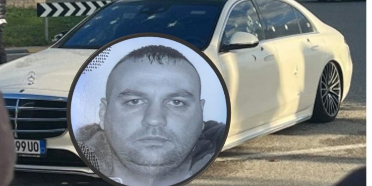 U plagos në atentatin e Rinasit, ja si paraqitet gjendja e Mustafa Sheqerit