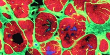 Studimi: Një gjen miqësor për zemrën kontribuon në rikuperimin pas një ataku kardiak