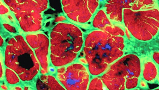 Studimi: Një gjen miqësor për zemrën kontribuon në rikuperimin pas një ataku kardiak