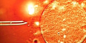 Skanadal i papritur: Në Europë është përdorur spermë nga dhurues me kancer, përfshirë Shqipërinë