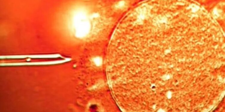 Skanadal i papritur: Në Europë është përdorur spermë nga dhurues me kancer, përfshirë Shqipërinë