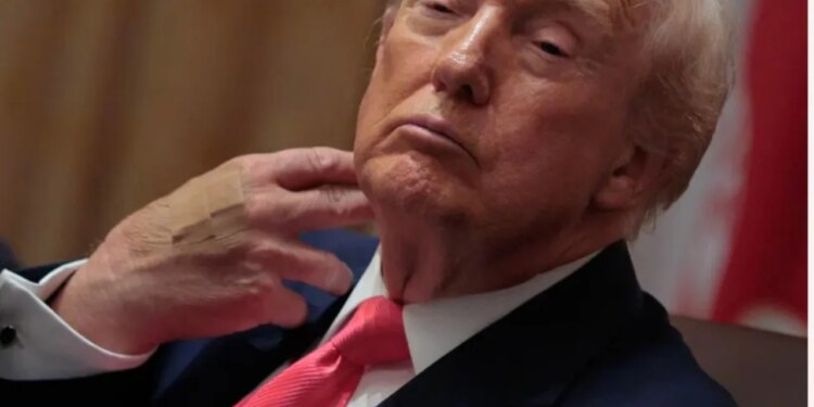 Trump me fashë në duar, Shtëpia e Bardhë: Ai nuk është në gjendje të keqe shëndetësore