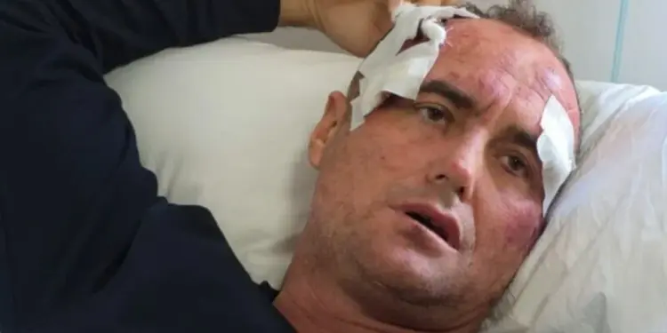 46-vjeçari nga Fieri reagon përsëri: 'Më agresivizuan në shtëpinë time persona me uniformë policie. Dua drejtësi.'