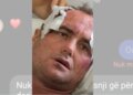 “Motra e 46-vjeçarit të dhunuar reagon pas publikimit të mesazheve private: ‘Mjaft me këtë telenovelë, s’kërkojmë hakmarrje, por…’”