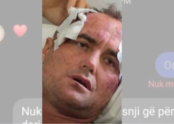 “Motra e 46-vjeçarit të dhunuar reagon pas publikimit të mesazheve private: ‘Mjaft me këtë telenovelë, s’kërkojmë hakmarrje, por…’”