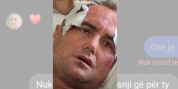 “Motra e 46-vjeçarit të dhunuar reagon pas publikimit të mesazheve private: ‘Mjaft me këtë telenovelë, s’kërkojmë hakmarrje, por…’”