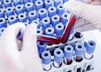 Përvetësoni Rh-null, ‘gjaku i artë’ që ka tërhequr vëmendjen e madhe të studiuesve për reproduktimin e tij në laborator.