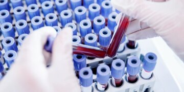 Përvetësoni Rh-null, ‘gjaku i artë’ që ka tërhequr vëmendjen e madhe të studiuesve për reproduktimin e tij në laborator.