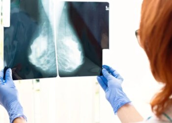 Revolucioni në terapi për kancerin e gjirit, një test i hulumtuesve britanikë parashikon terapinë më efektive për secilin pacient.