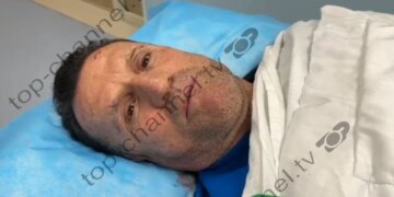 Dëmtim në një pikë karburanti: Avokati Cakrani rrëfen për TCH se njëri e ofendonte, ndërsa tjetri e goditi pas koke me një mjet prerës.