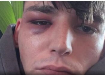 Ngjarje tronditëse në Këln; arbitri Kaiser sulmohet pas propozimit për martesë ndaj partnerit të tij…