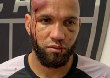 Imazhe surprizuese: Si përfundoi portieri Everson në finalen Cruzeiro–Atlético MG