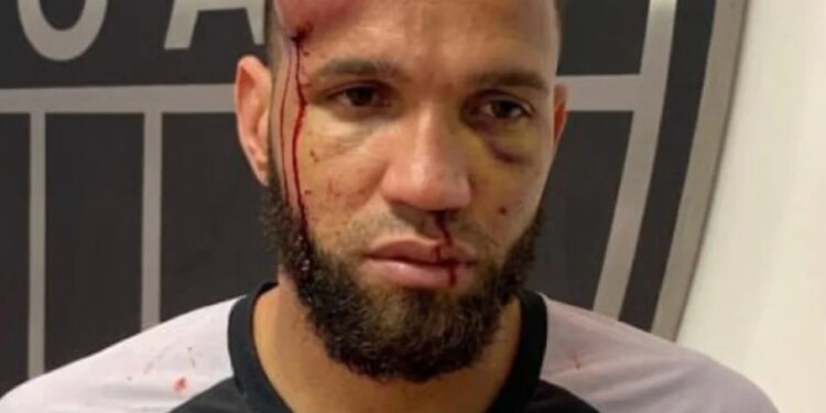 Imazhe surprizuese: Si përfundoi portieri Everson në finalen Cruzeiro–Atlético MG