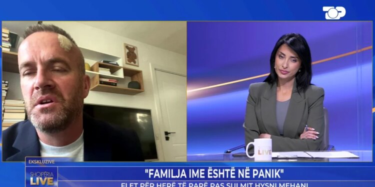 Kreu i LVV i dhunuar thotë Më ra topi në kokë dhe shpreson: rasti të jetë i fundit