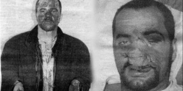 Më lanë në tokë, menduan se mbarova — Dhuna fizike në ’97, Rama: Më thanë që ishte tentativë vrasjeje