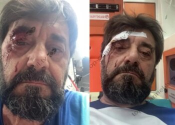 Arrestohet i dyshuari për dhunën ndaj analistit Ilir Demalia
