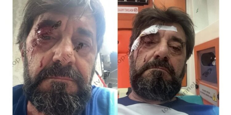 Arrestohet i dyshuari për dhunën ndaj analistit Ilir Demalia