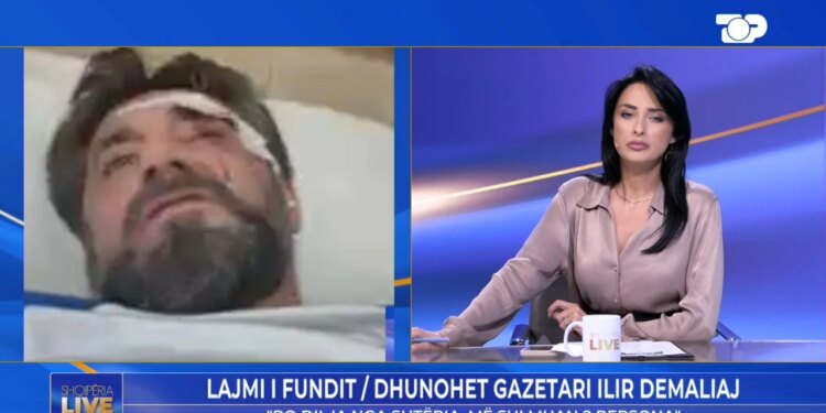 Dhunimi i Ilir Demaliajt, analisti sqaron në Shqipëria Live: Dy persona më goditën, thanë se kisha lajmëruar policinë…