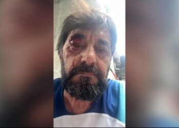 Goditja e analistit Ilir Demalia, Lutfi Dervishi: Dhuna ndaj njeriut s’mund të relativizohet, justifikohet apo madje të festohet