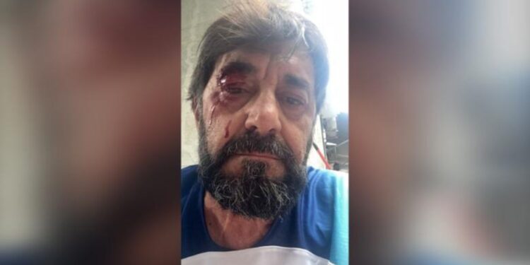 Goditja e analistit Ilir Demalia, Lutfi Dervishi: Dhuna ndaj njeriut s’mund të relativizohet, justifikohet apo madje të festohet