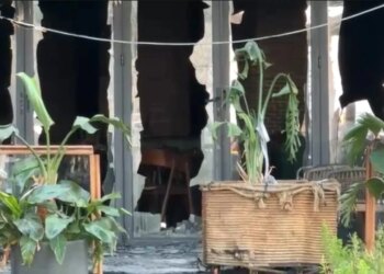 25-vjeçarja me djegie në 85% të trupit pas zjarrit në Vlorë, niset për trajtim specializuar në Turqi