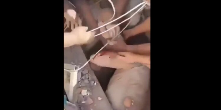 Mrekulli mes tragjedisë: Foshnja 6-muajshe nxirret e gjallë nga rrënojat e tërmetit në Kolumbi