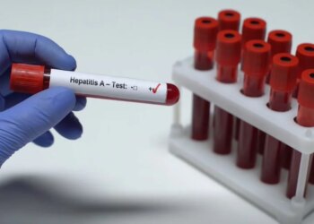 Shqipëria miraton për herë të parë Planin Kombëtar për Eliminimin e Hepatiteve Virale