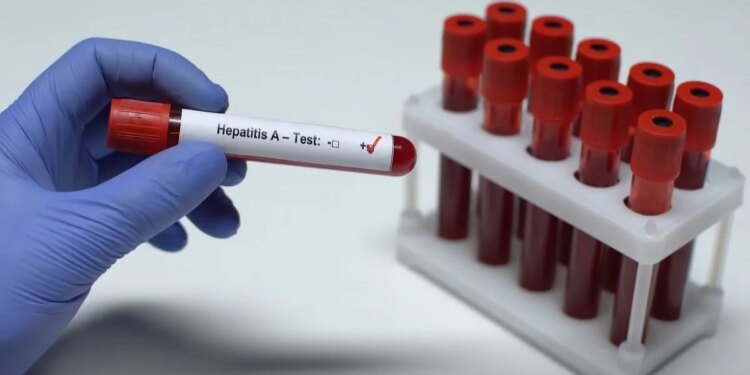Shqipëria miraton për herë të parë Planin Kombëtar për Eliminimin e Hepatiteve Virale