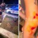 Turistët italianë denoncojnë: Policia nuk reagoi, na dhunuan në mes të sheshit dhe publikojnë fotot