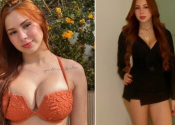 E papritur: Influencerja e njohur ndahet nga jeta në moshën 22-vjeçare pak javë pas operacionit të gjoksit