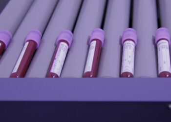 Shtohen rastet me kancer gjaku, hematologu Ivanaj: 55 raste të reja diagnostikohen çdo vit në Shqipëri