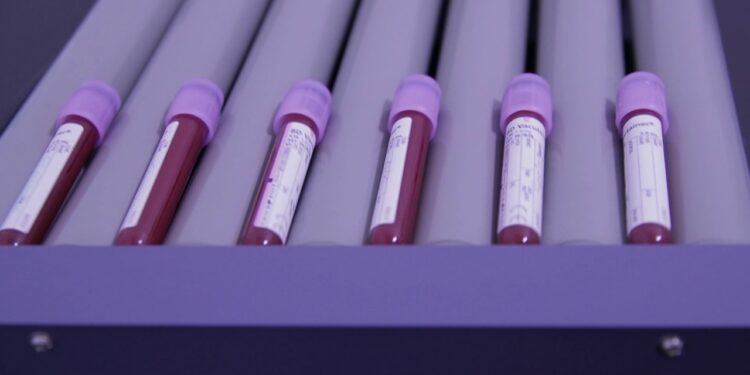 Shtohen rastet me kancer gjaku, hematologu Ivanaj: 55 raste të reja diagnostikohen çdo vit në Shqipëri