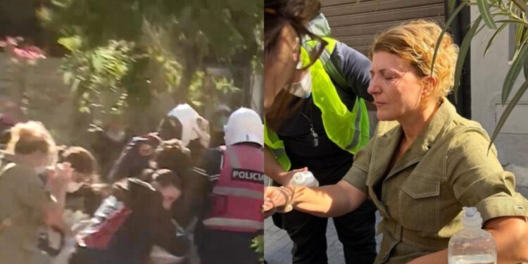 Bashkëshortja e Sokol Olldashit lëndohet gjatë protestës