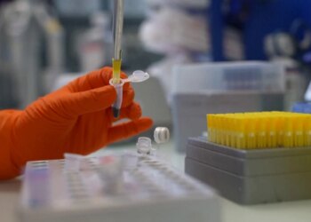 Çfarë është murtaja pneumonike që doli nga laboratori rus dhe po shqetëson botën
