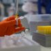 Çfarë është murtaja pneumonike që doli nga laboratori rus dhe po shqetëson botën