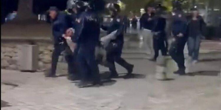 Efektivët e dhunuan dhe i thyen këmbën; 19-vjeçari ishte kalimtar, jo protestues