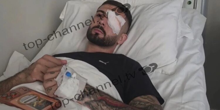 Ekskluzive: Plumbin e kam ende në sy, 28-vjeçari i plagosur në protestë rrëfen para nisjes drejt Italisë
