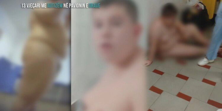 Fiks Fare: Skandal në QSUT, stafi i spitalit iu drejtohet pacientëve në psikiatri me sharje banale