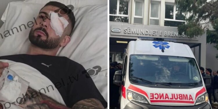Kemi shenja pozitive, niset për Itali 28-vjeçari i plagosur me plumb në sy; shefja okulistikës: Do të operohet