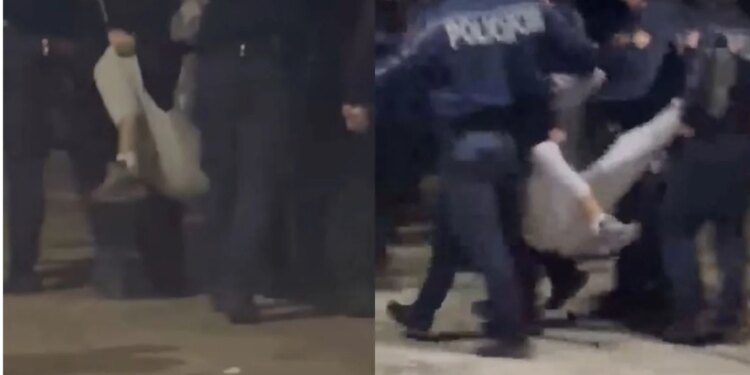 Më thyen këmbën policët — efektivët e dhunuan, gazetarja raporton nga Trauma: 19-vjeçari nuk ishte protestues