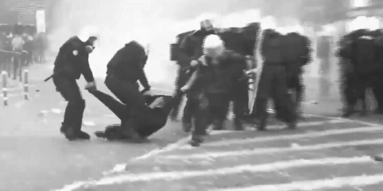 Ndjeva që u përplasa fuqishëm… dëshmia ekskluzive e Ledion Ballës: policët i thyen këmbën në protestë