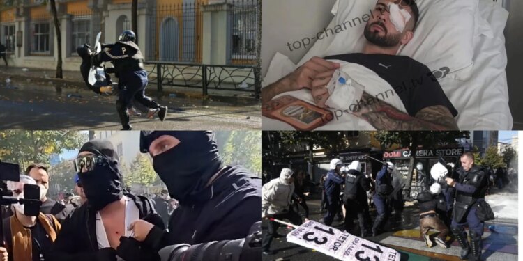 Plagosja e Vishkullit dhe studentëve me dëmtime të rënda — prokuroria pret provën italiane: plumb gome apo material tjetër?