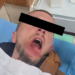 Stop plumbave mbi studentët — Berisha nxjerr foton e një protestuesi të lënduar në fytyrë, dyshohet me plumb gome